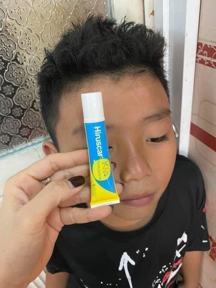 Kem bôi sẹo hiruscar kids thái lan