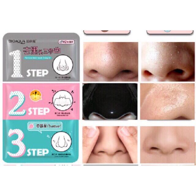 Set lột mụn 3 bước