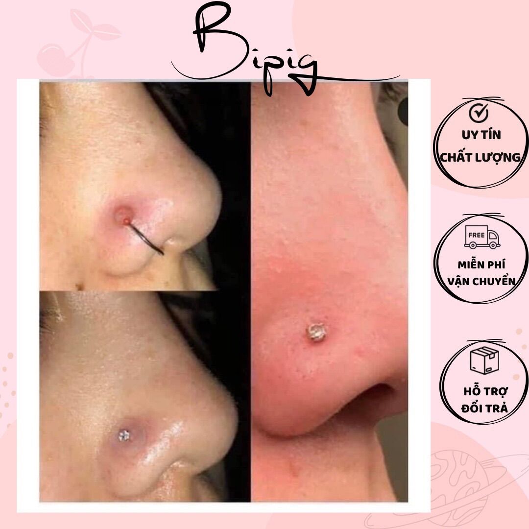 COMBO 5 MIẾNG Nopull Disc / Miếng Nẹp Bump - Nẹp bump / Đệm siết , nẹp khuyên mũi /khuyên tai/ khuyên cơ thể bị bump