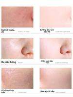 LIDAORIJI | Sữa Rửa Mặt Chứa Lưu Huỳnh Dịu Nhẹ Se Khít Lỗ Chân Lông Loại Bỏ Mụn Đầu Đen Làm Sạch Sâu Kiểm Soát Dầu Loại Bỏ Kí Sinh Trùng