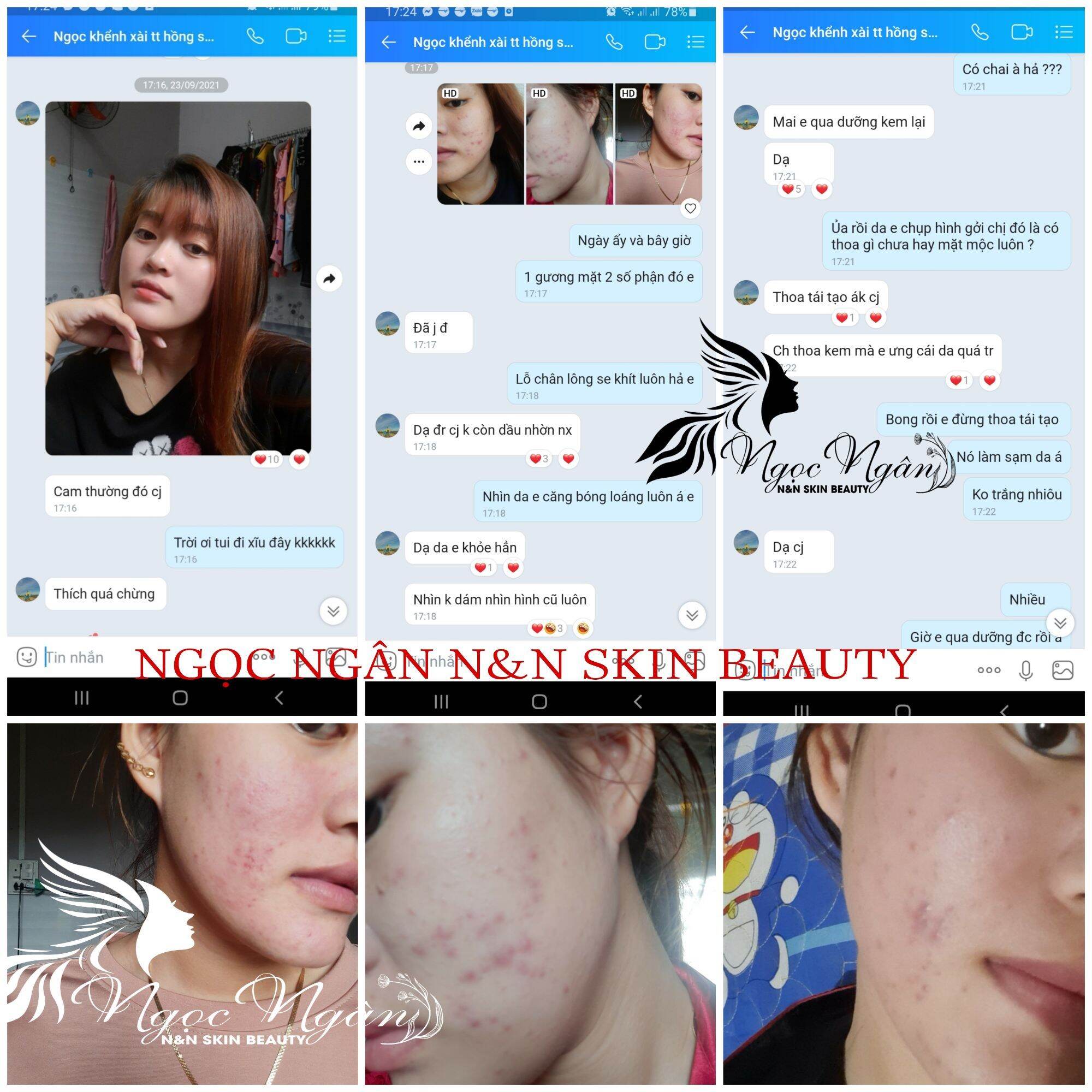 Combo Tái Tạo Hồng Sâm ( tinh chất hồng sâm + bột thảo dược rửa mặt)