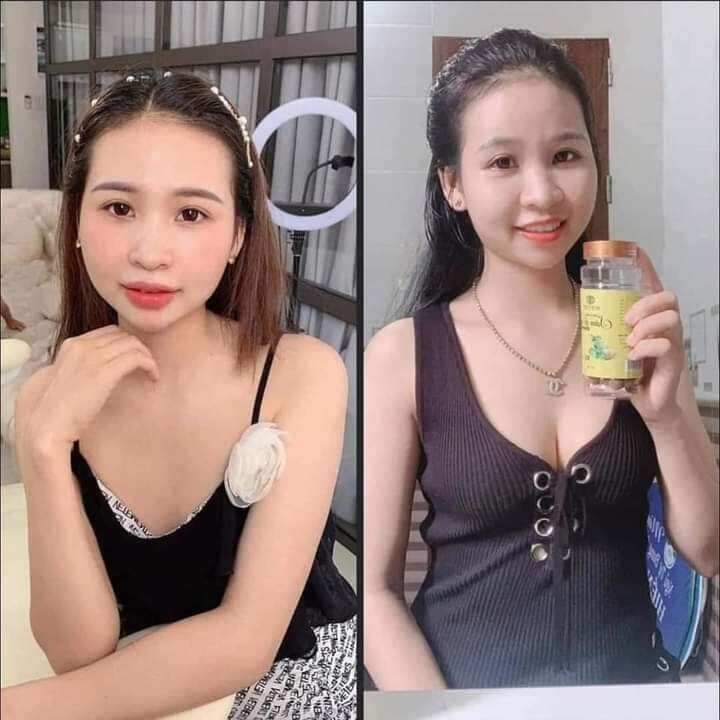 Kẹo mầm sâm tố nữ Xmax Mychi