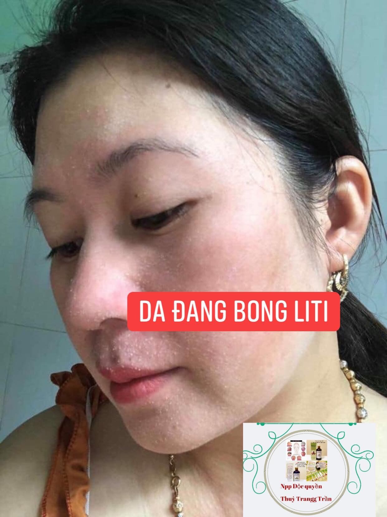 Tái Tạo Da (50ml).