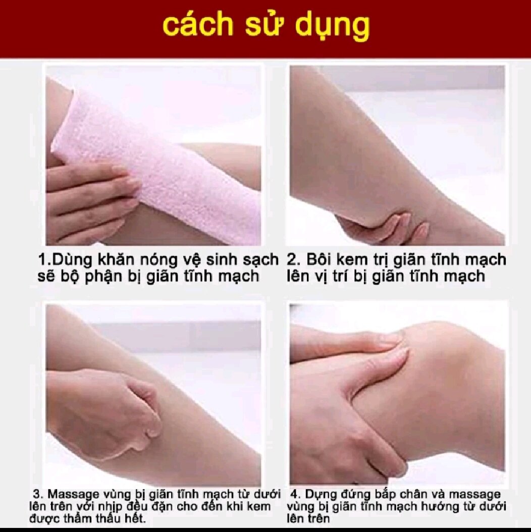 KEM BÔI SUY GIÃN TĨNH MẠCH