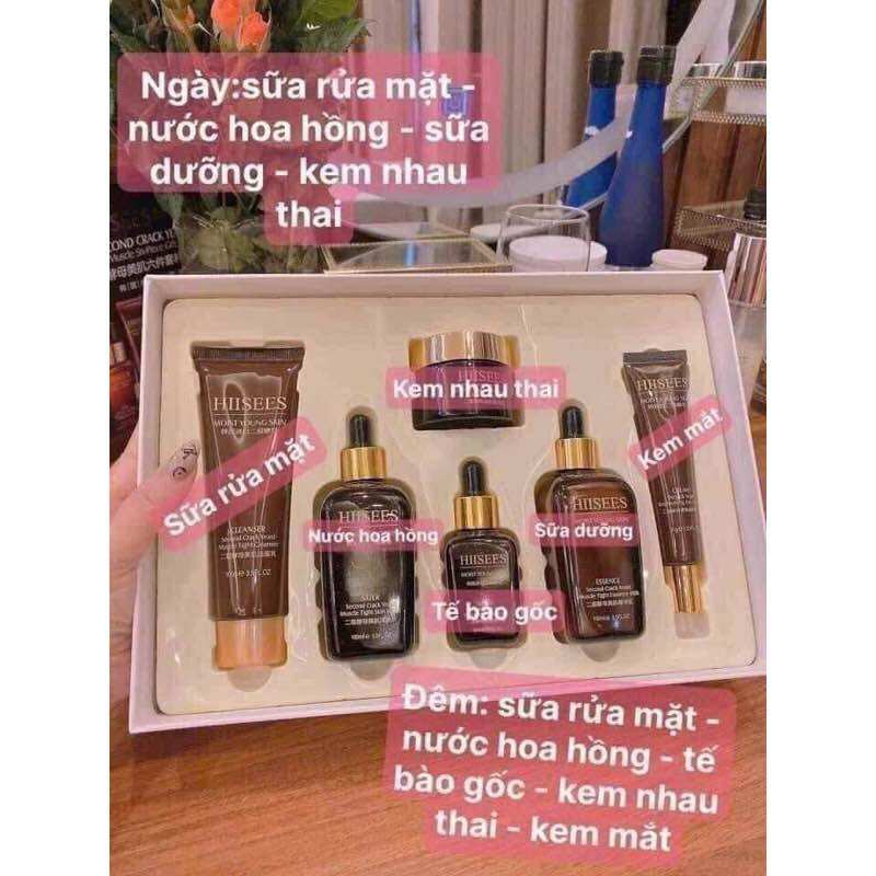 Kem dưỡng trắng da HISES, bộ 6 món