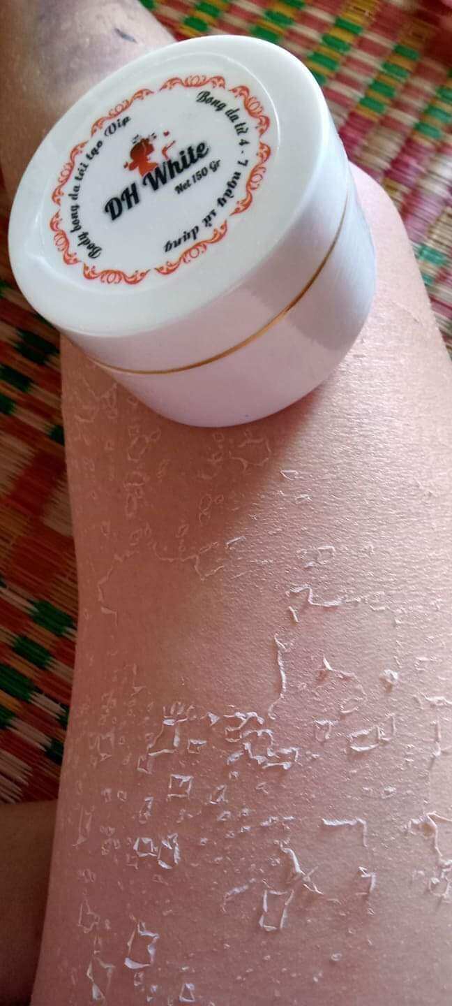 Kem Bong Da Kích Trắng