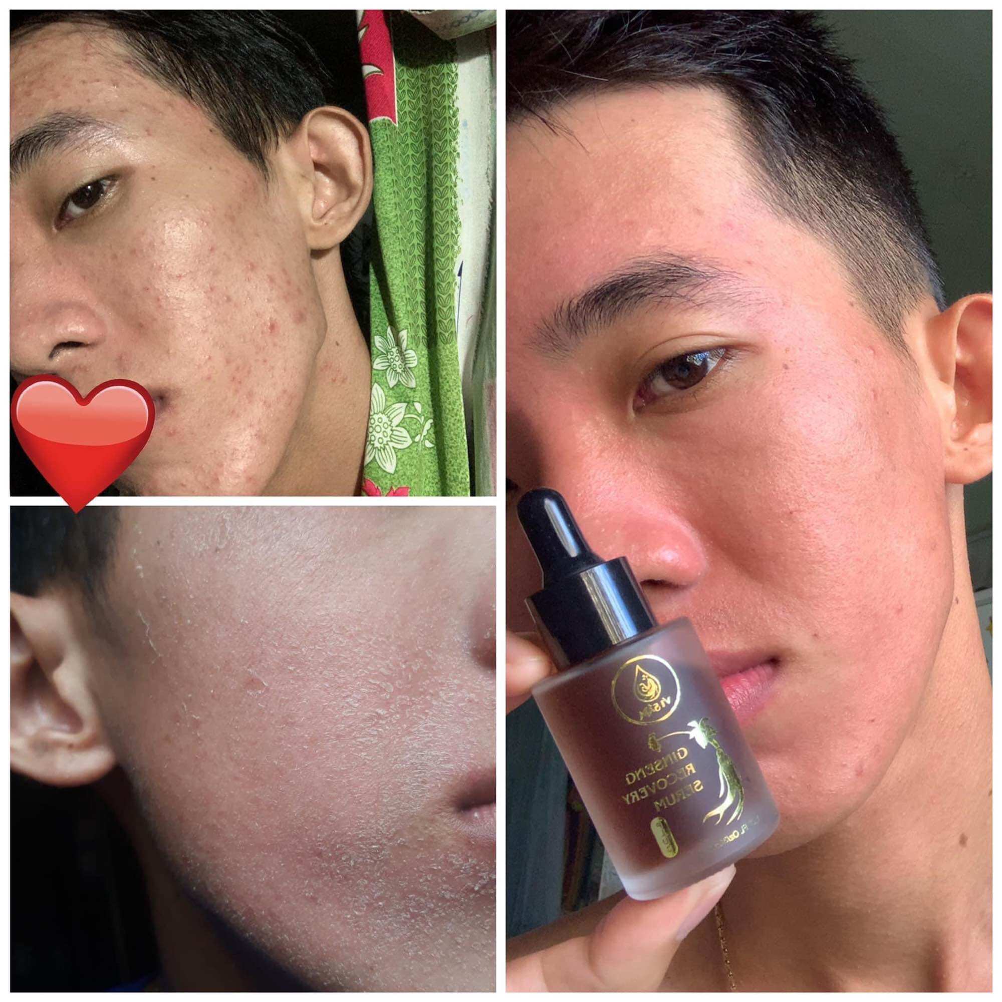 Tái Tạo Da Vi Sâm Plus