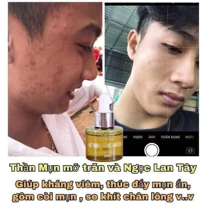 Serum Mỡ Trăn Ngọc Lan Tây