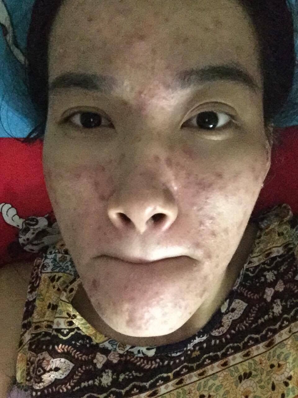 Tái Tạo Thanh Trang( Loại Cấp Tốc)