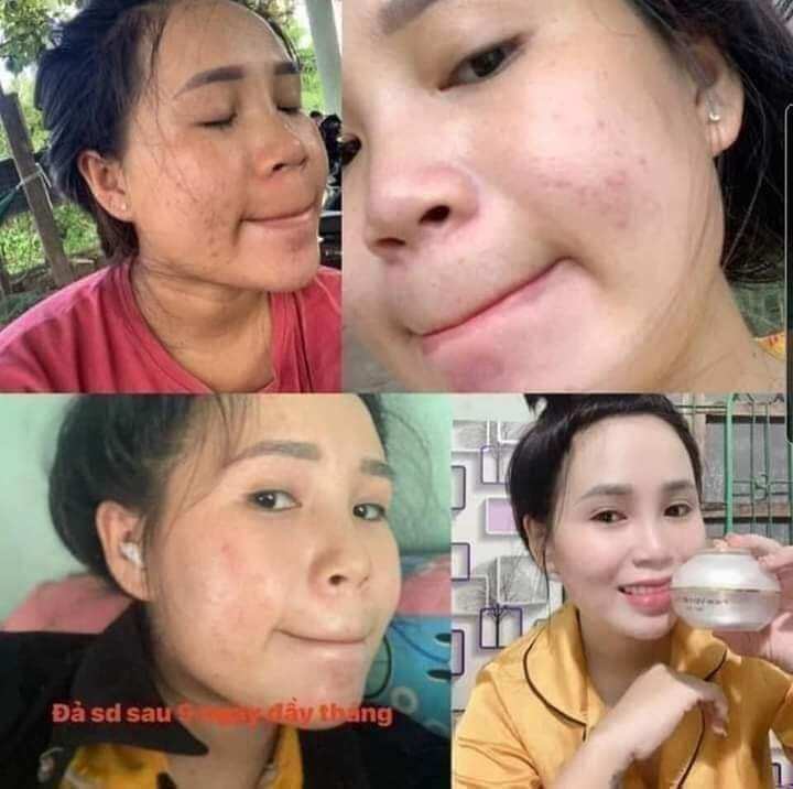 [TẶNG KÈM SERUM VÀNG 24K+ MẶT NẠ] Kem face vip 7 in 1 Huỳnh Đỗ