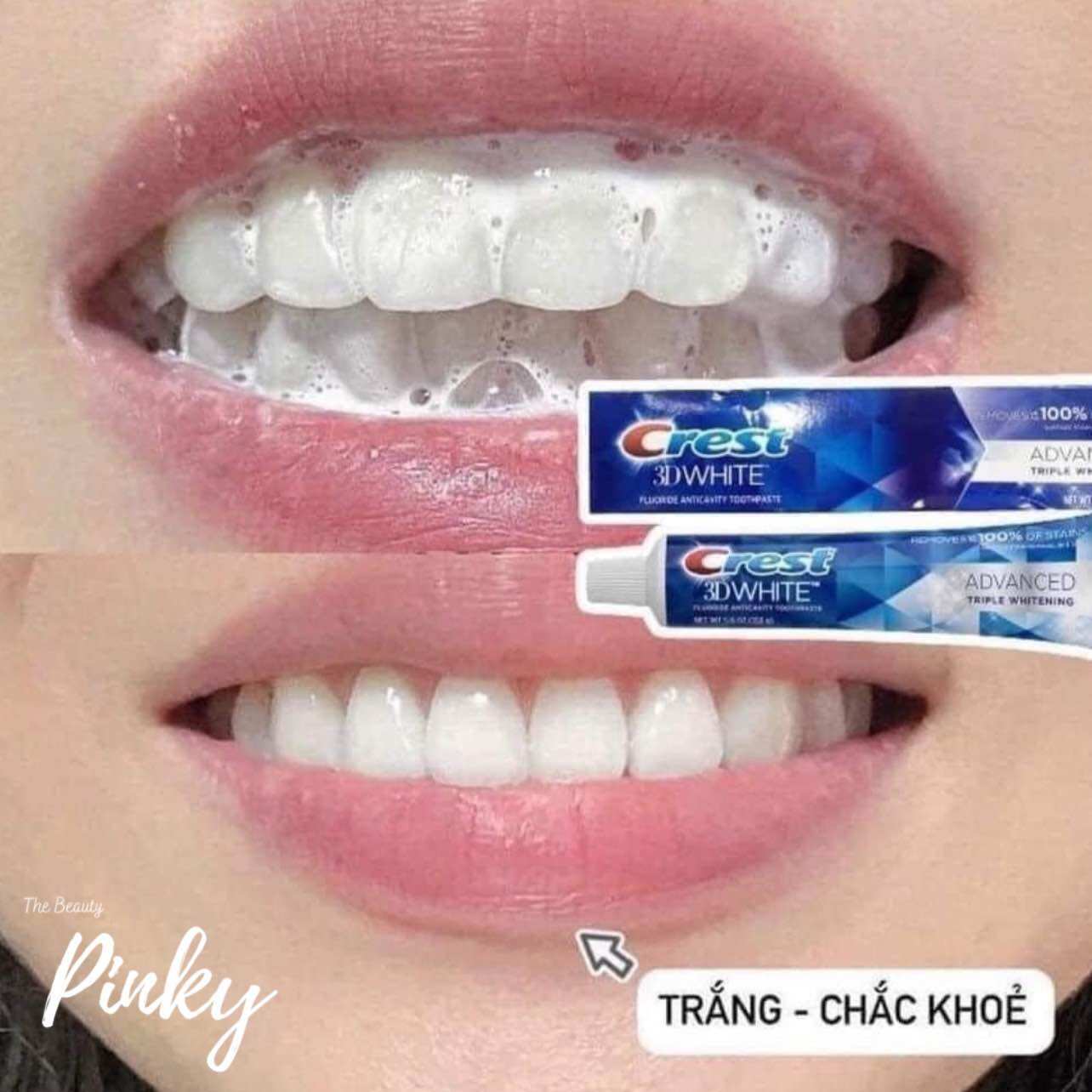 [Chính hãng] Kem đánh răng CREST 3D WHITE ADVANCED