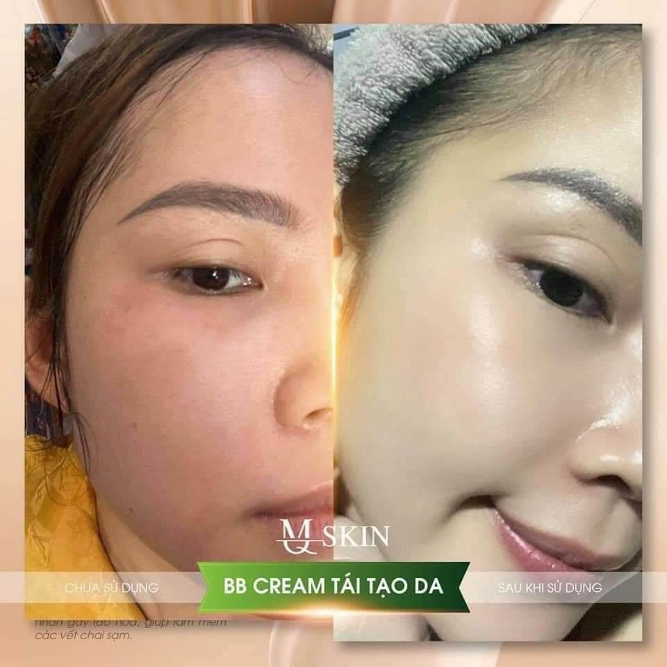Serum Căng Bóng Da Nhân Sâm MQ SKlN
