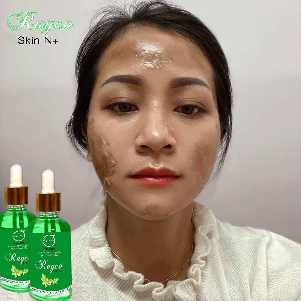 Peel Bong Mạnh Tái Tạo Da