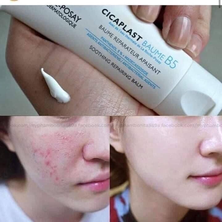 Kem dưỡng B5 La roche-posay 100ml