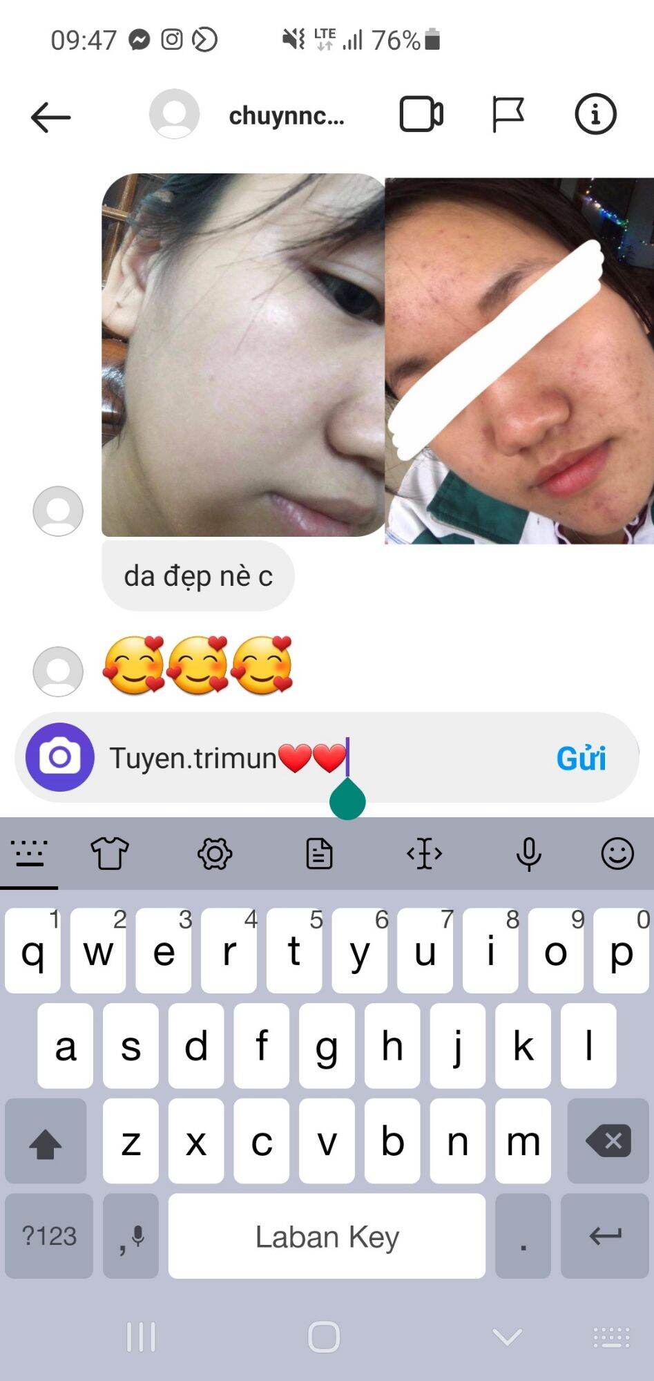 Đông y Sắc Ngọc Nữ  tái tạo da mụn, thâm