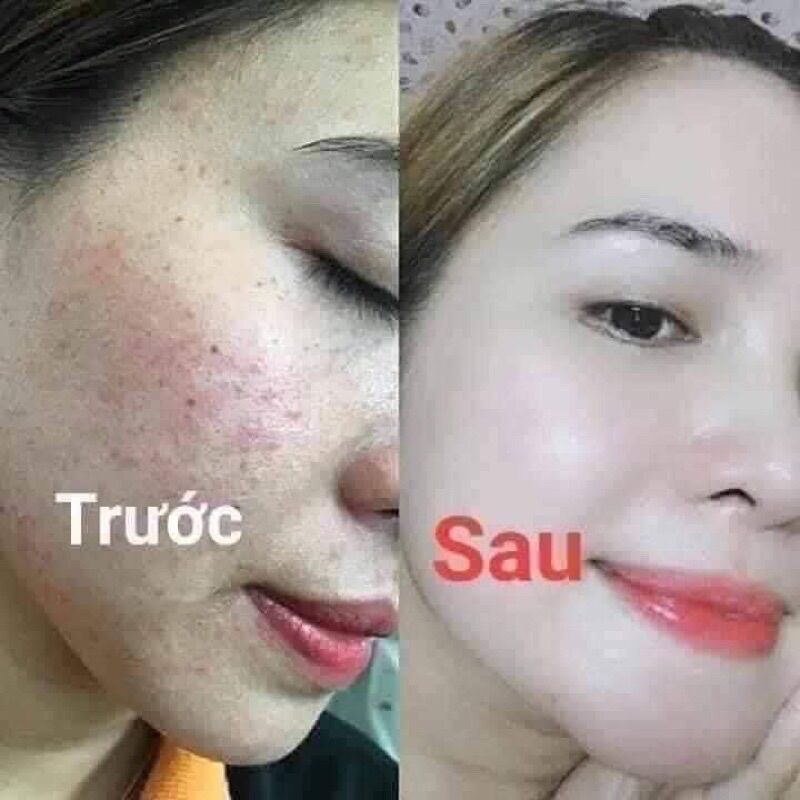 Sữa rửa mặt Hoàng cung hồng trắng da sạch nhờn