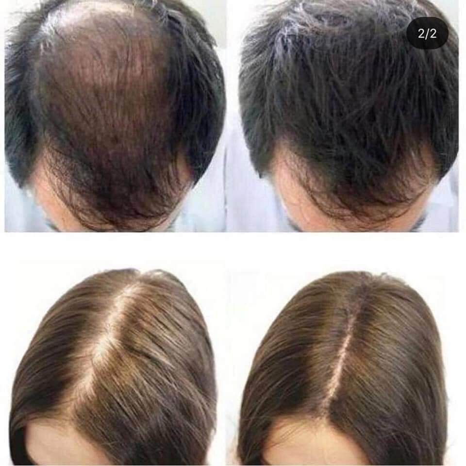 TINH CHẤT KÍCH THÍCH MỌC TÓC SATO NHẬT NỘI ĐỊA