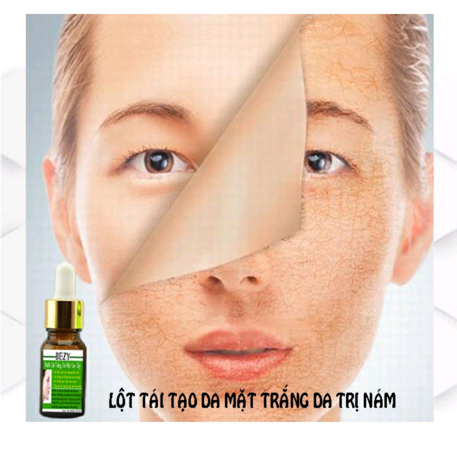 Peel Da Mặt Xóa Nám Sạm Tàn Nhang Trắng Da Bezy