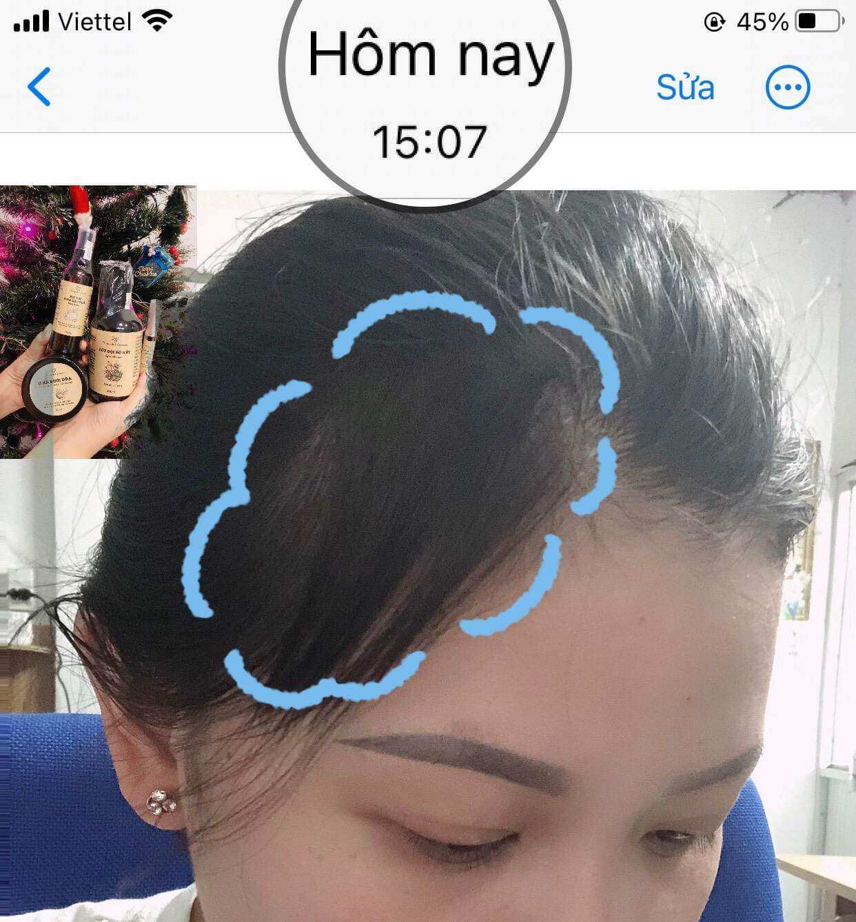 [THIÊN NHIÊN] DẦU GỘI BỒ KẾT