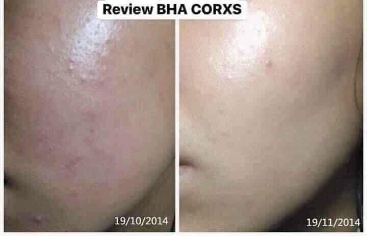 Toner Cosrx AHA/BHA