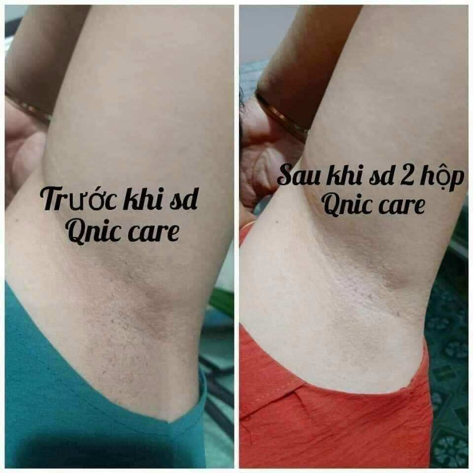 (15gram) Hũ trắng nách Q-nic Care Thái lan