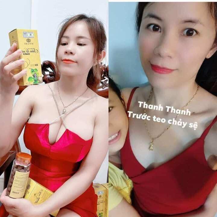 Kẹo mầm sâm tố nữ Xmax (mua 4 tặng 1= 5 hộp)