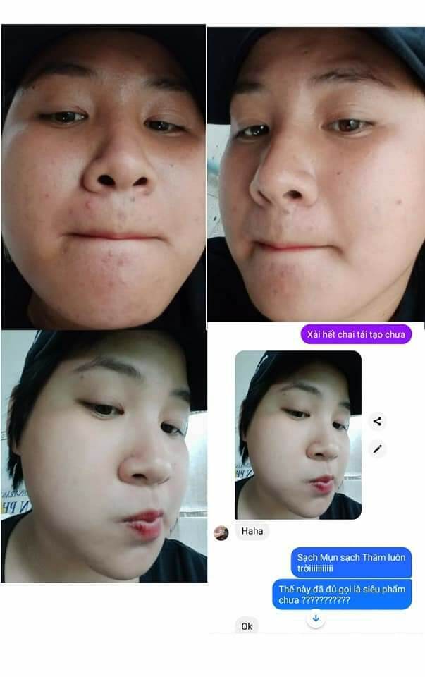 TÁI TẠO HỒNG SÂM