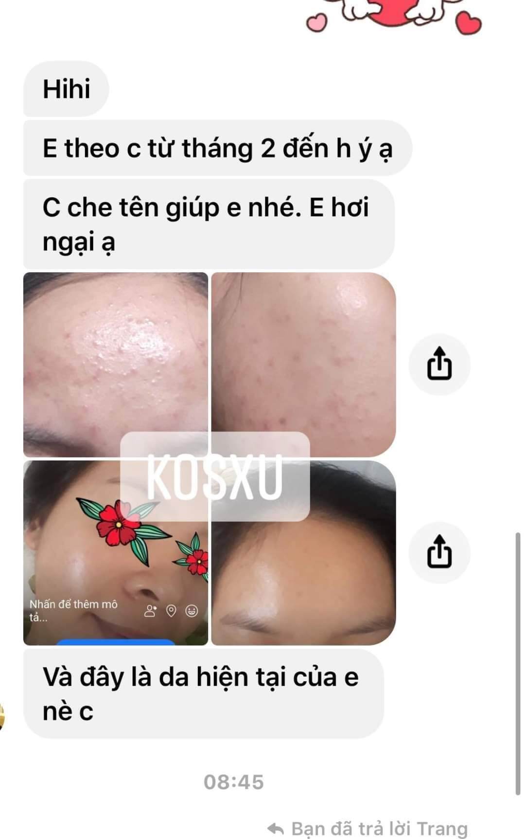 Serum ong Kosxu căng bóng thánh mụn ẩn