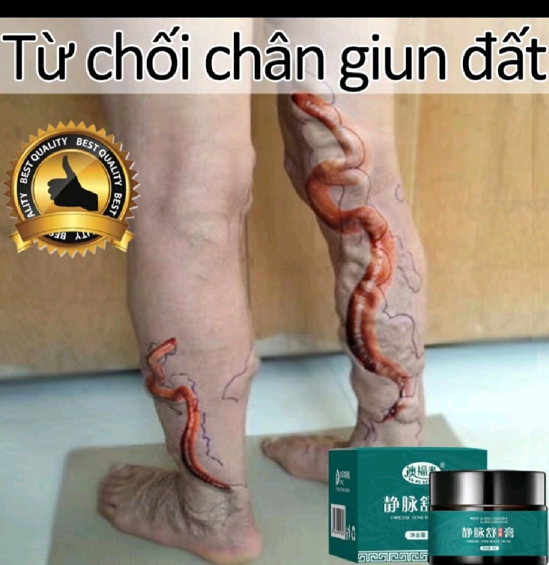 KEM BÔI SUY GIÃN TĨNH MẠCH