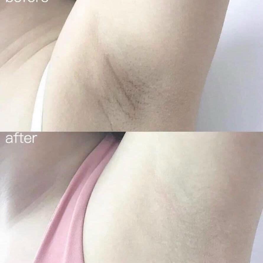 Lăn nách Scio’n luôn giúp bạn tự tin
