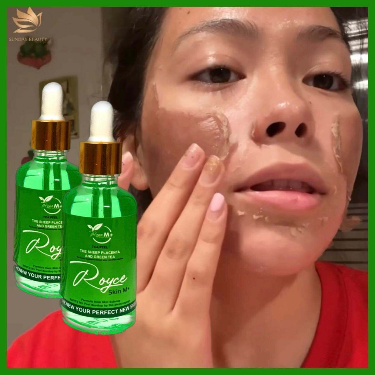 PEEL DA BONG MẢNG TO ROYCE SKIN M+ PEEL DA - PEEL DA - PEEL DA