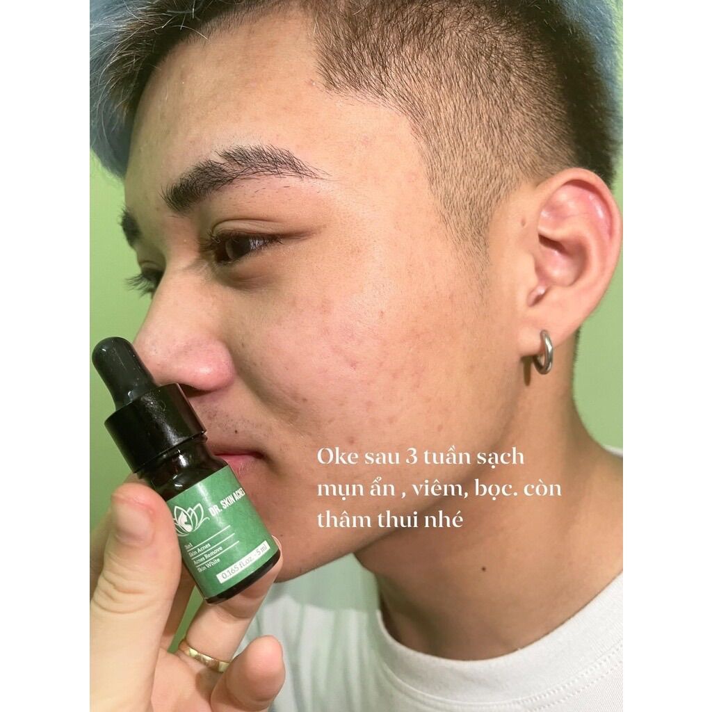 (cam kết chính hãng) SERUM XÓA MỤN THÂM DR.SKINACNES ( Dr.skin acnes )