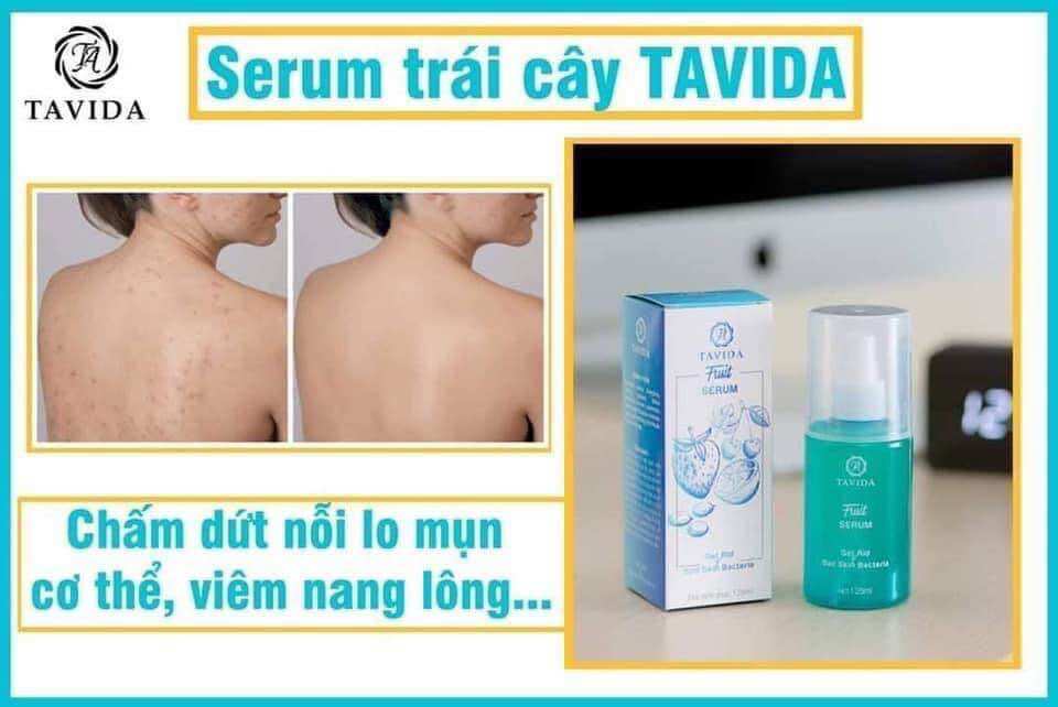 ( mẫu mới) XỊT MEN VI SINH TAVIDA DỨT ĐIỂM TẬN GỐC VIÊM NANG LÔNG, MỤN LƯNG, MỤN NGỰC