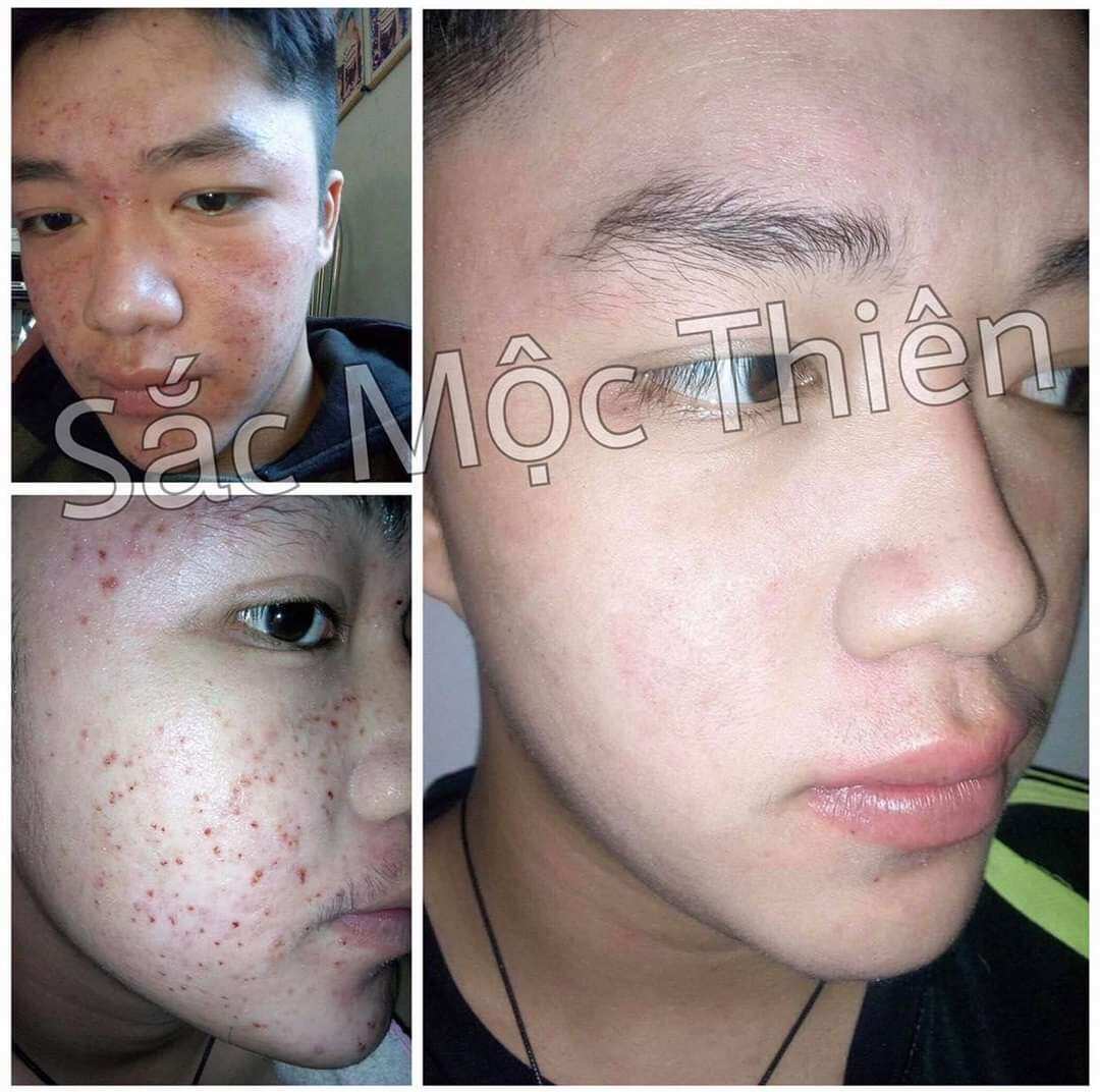 CHÍNH HÃNG Sắc Mộc Thiên Linh Chi Mộc