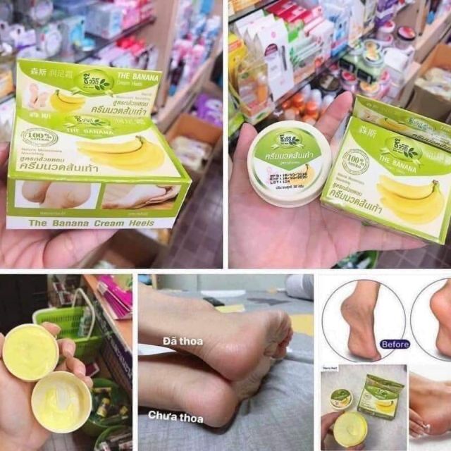 Kem Trị Nứt Gót Chân Chuối Thái Lan