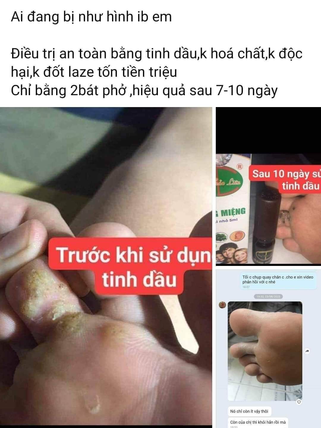 Tinh dầu dạ Thảo liên 5ml bán sỉ