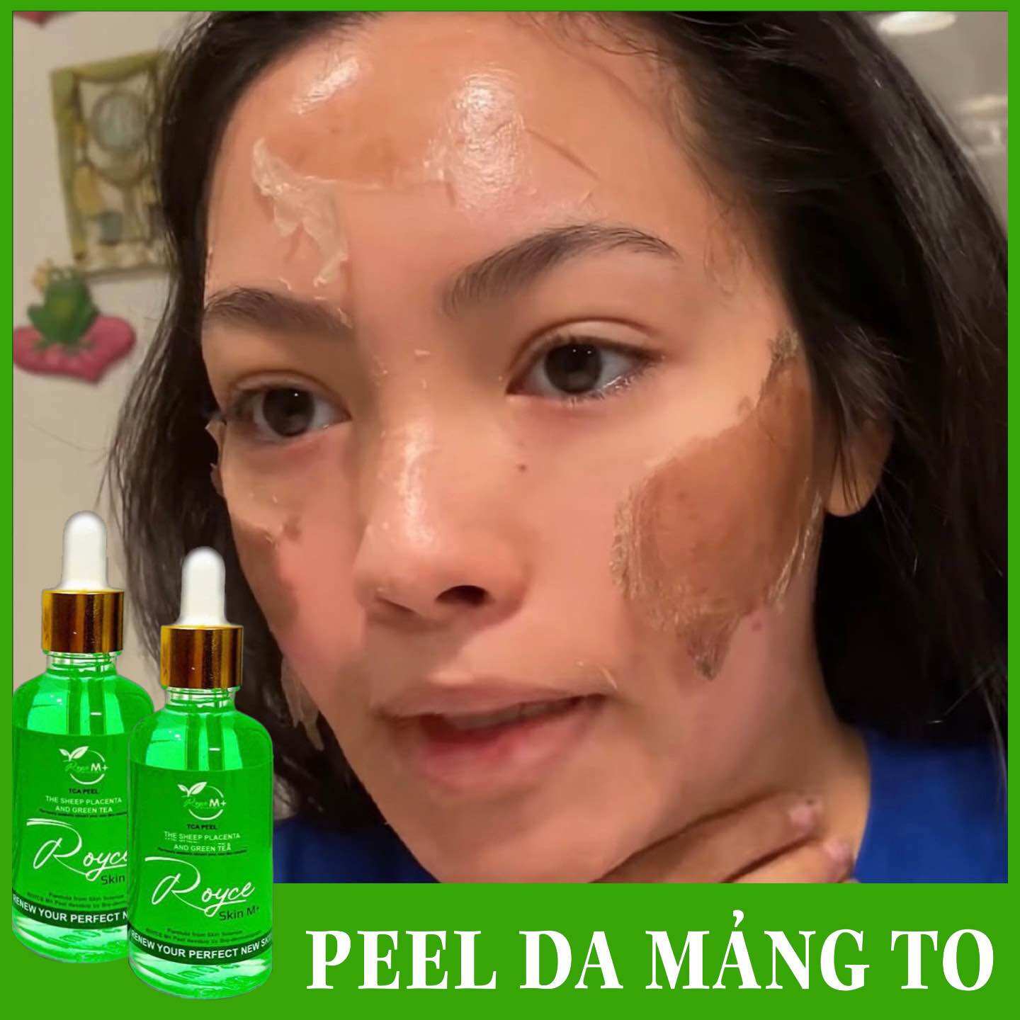Peel da bong mảng to royce skin m+ peel da - peel da - peel da - peel da