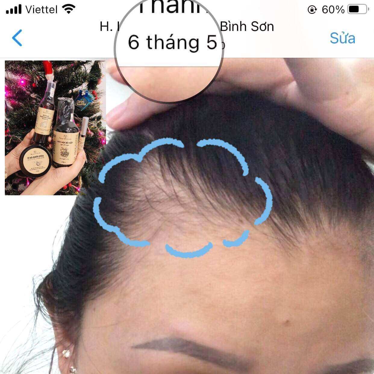 [THIÊN NHIÊN] DẦU GỘI BỒ KẾT