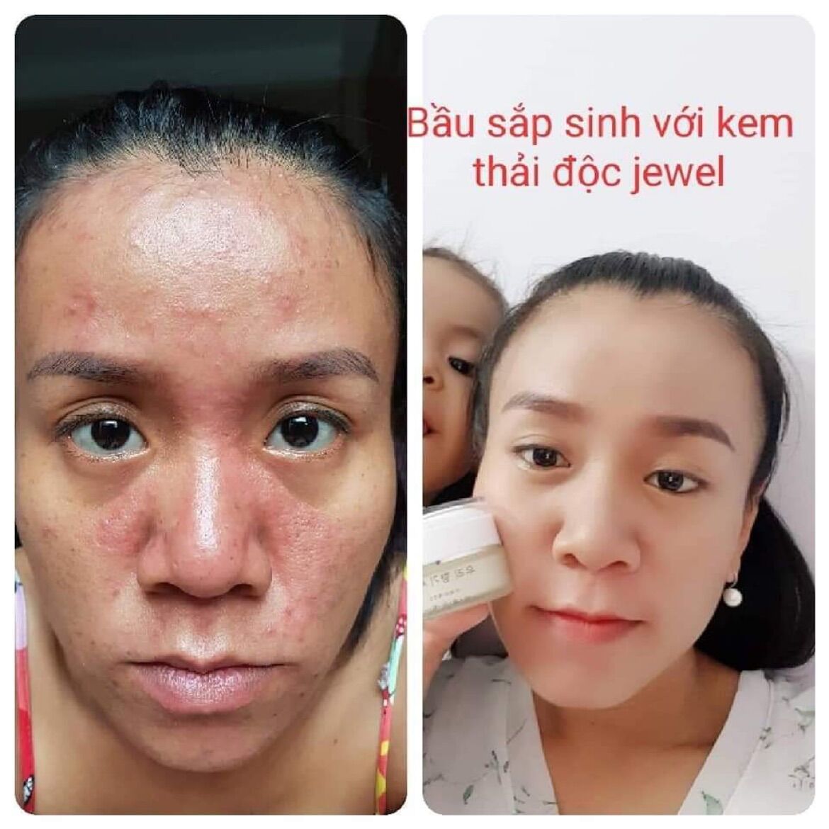 Kem Thải Độc Da Jewel Hàn Quốc 20g