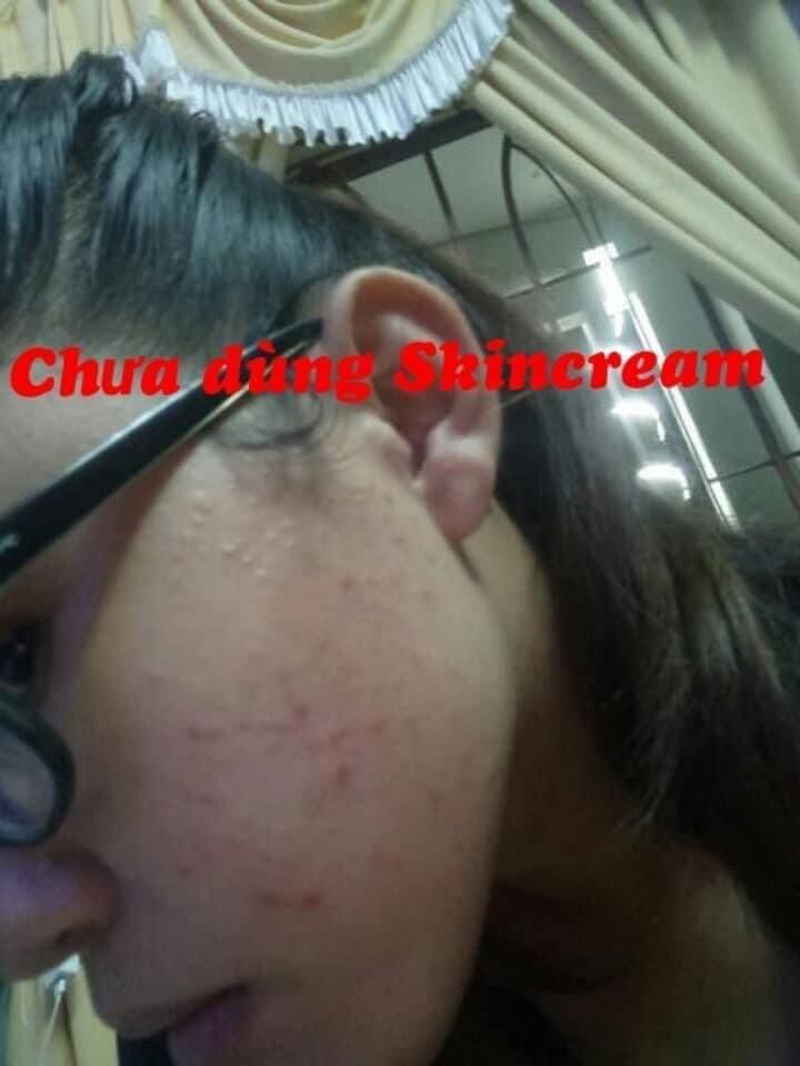 KEM LINH CHI