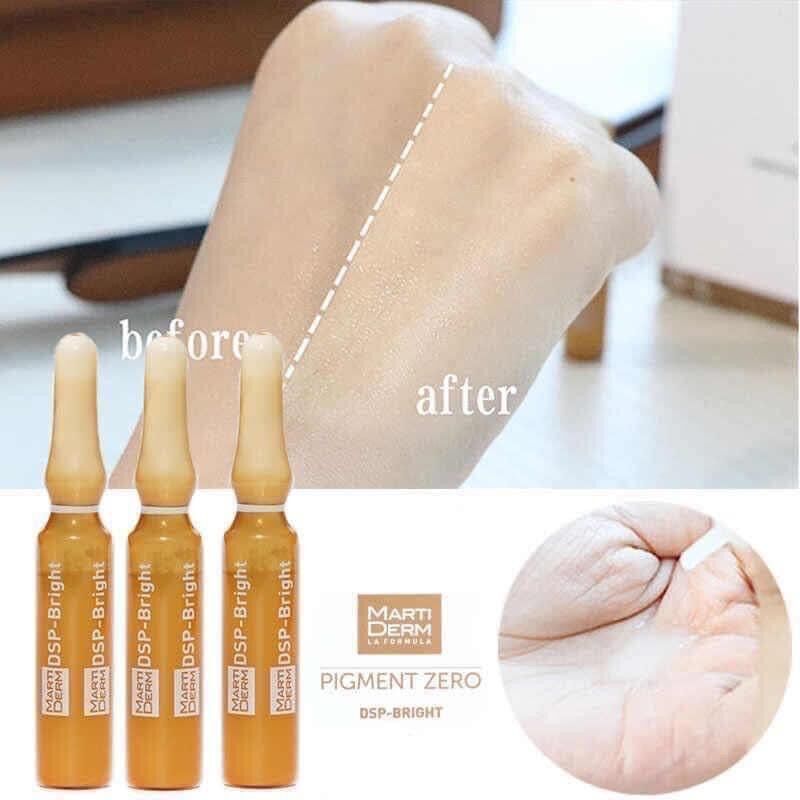 Martiderm Pigzero DSP Bright dưỡng sáng đều màu