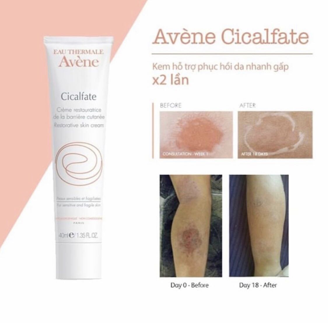 [HCM]Kem dưỡng ẩm phục hồi da Avene Cicalfate 40ml