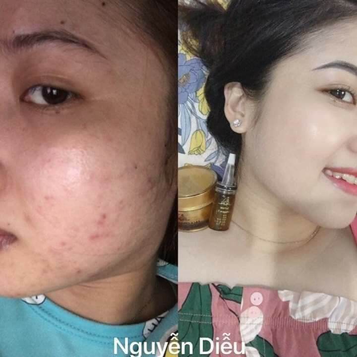 [HCM]KEM FACE COLLAGEN X3 ĐÔNG ANH