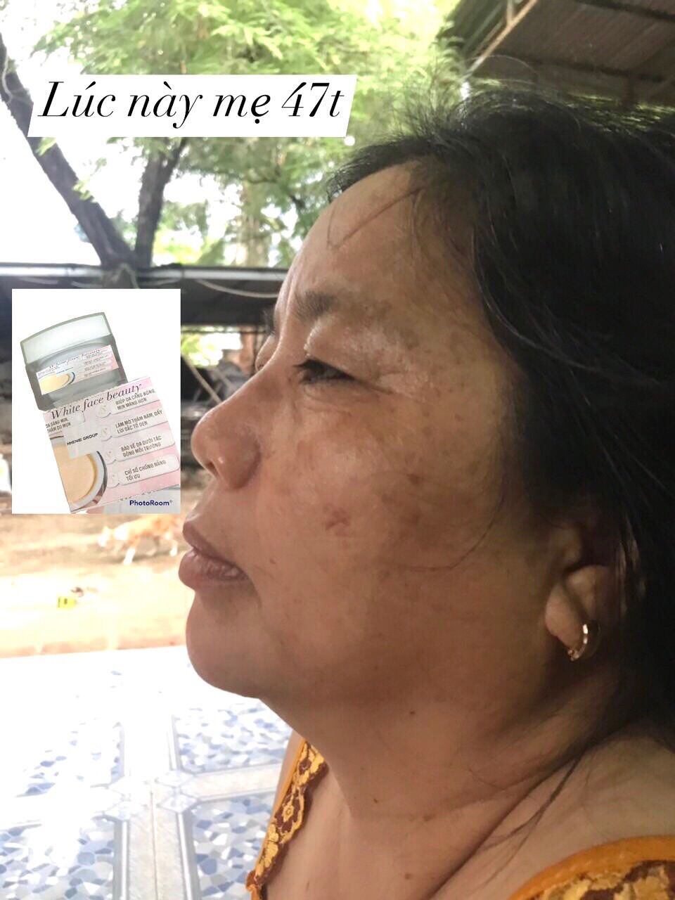 KEM  TRẮNG Da