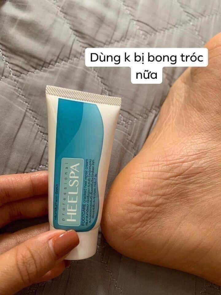 Kem tr.ị nứt nẻ tay chân Heel Spa