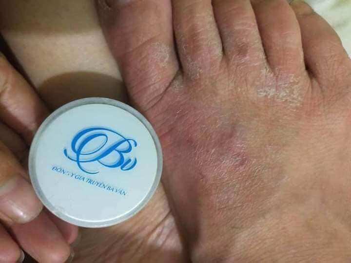 KEM ĐA NĂNG ĐÔNG Y BÀ VÂN