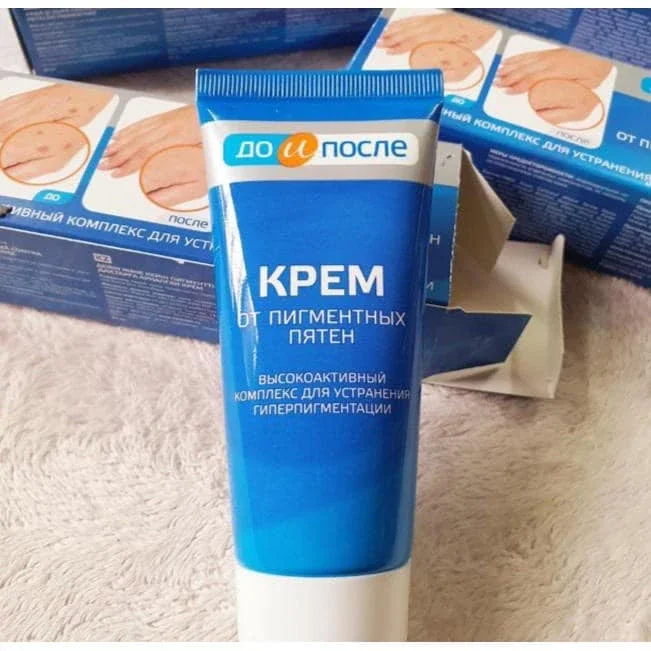Kem đồi mồi kem Nga 50ml xoá đồi mồi tàn nhang dưỡng da tay