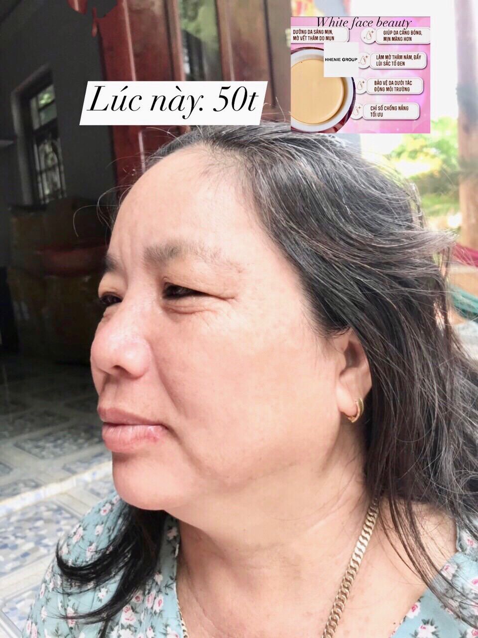 KEM  TRẮNG Da