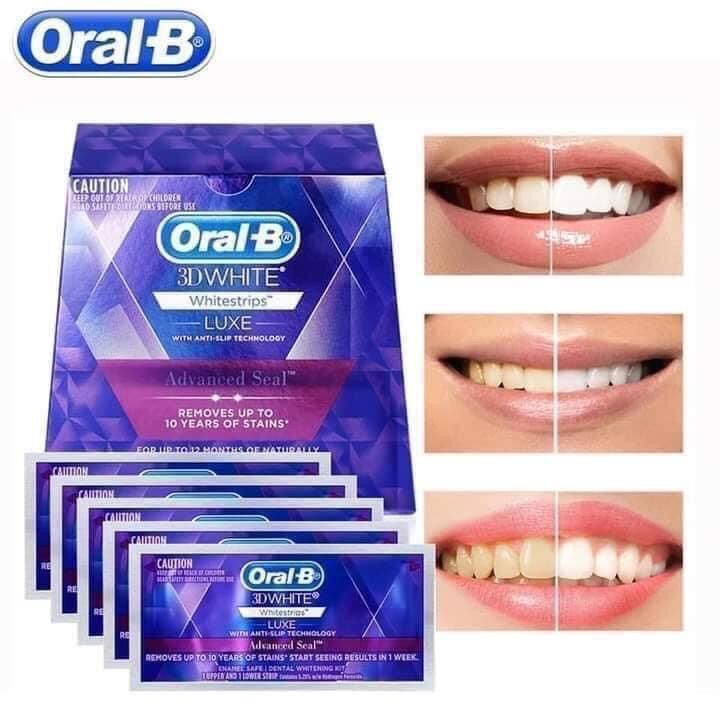 Miếng dán trắng răng Oral B 3D White Whitestrips (14 gói/hộp)