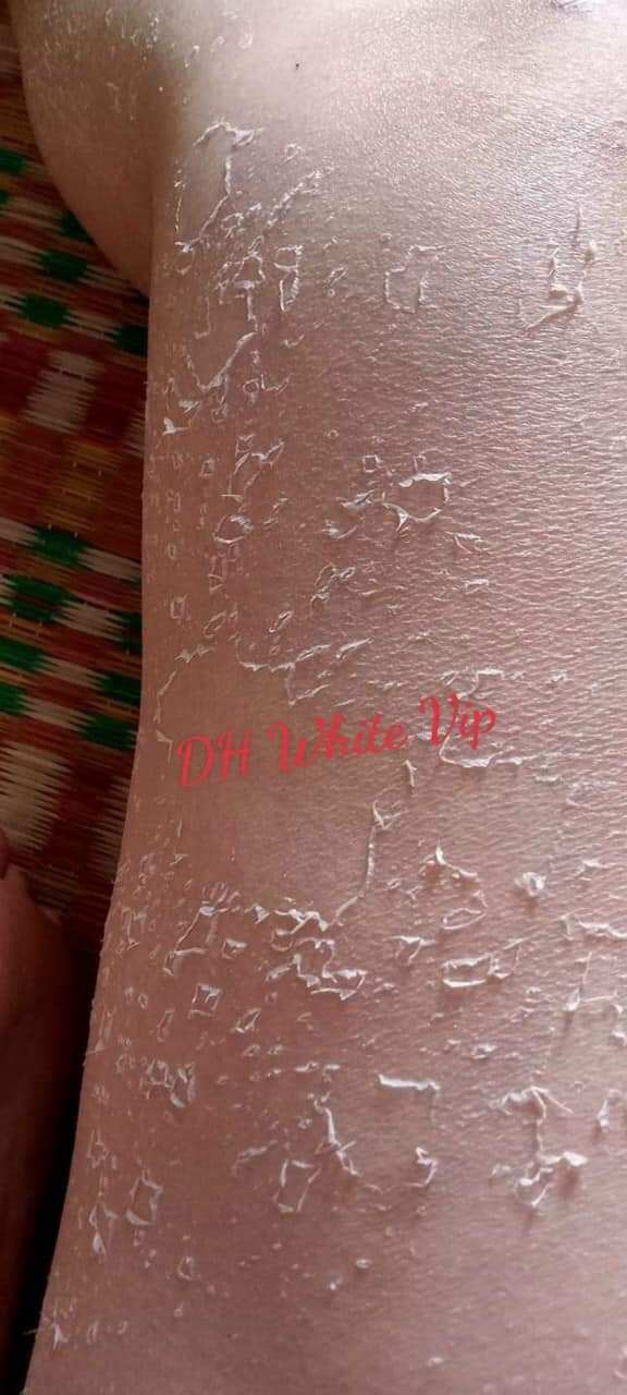 Kem Bong Da Kích Trắng